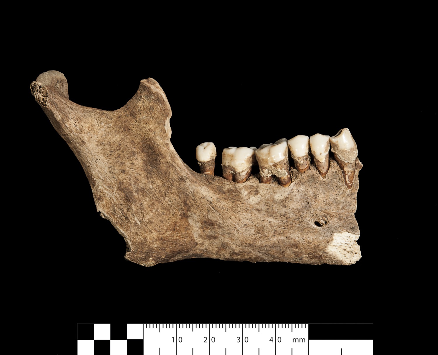 Machoire inférieure